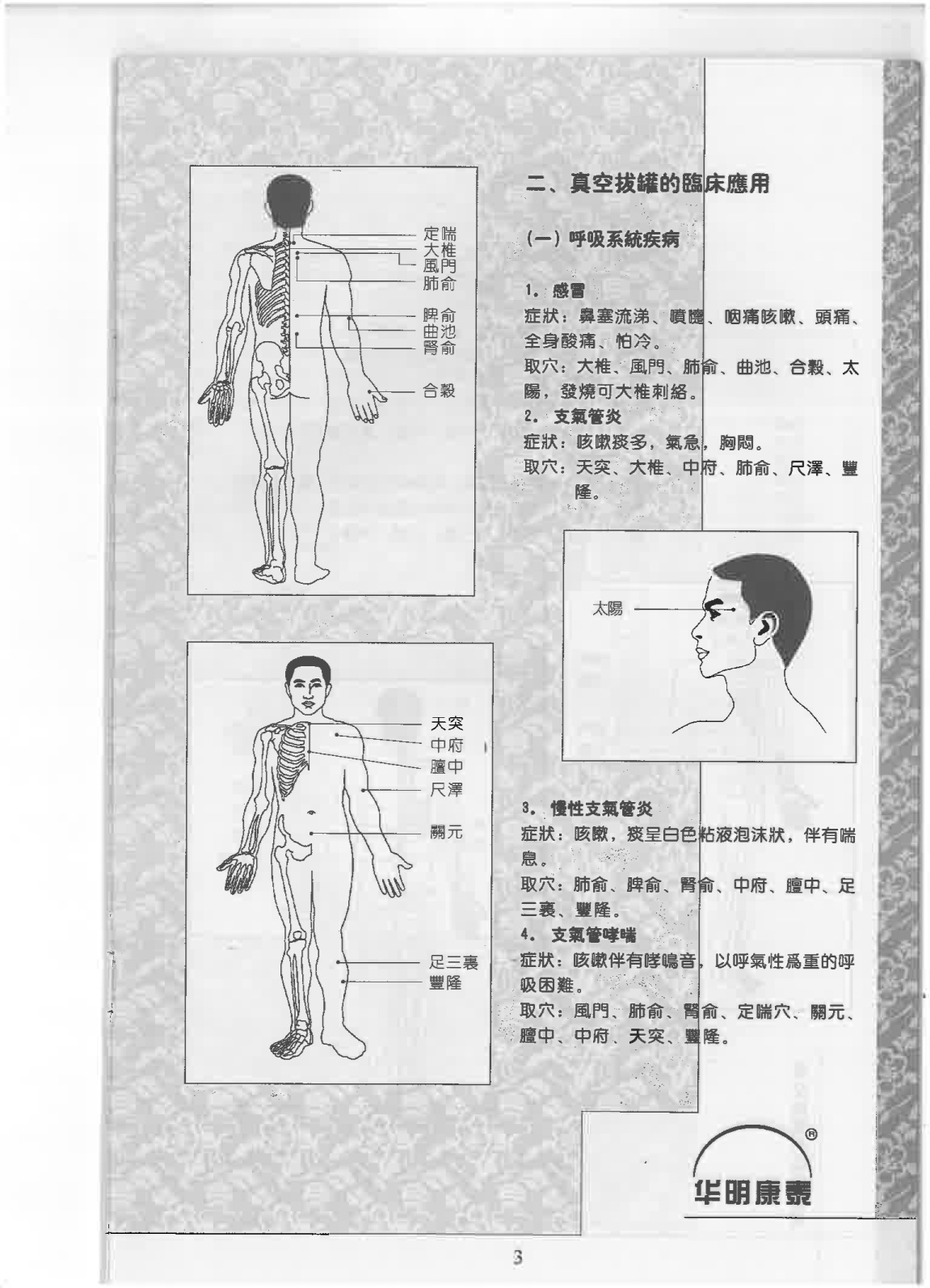 拔罐療法